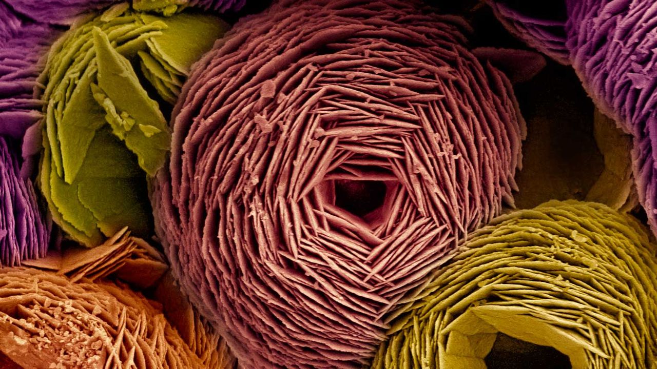 ｢バテライトの電子顕微鏡写真｣ 